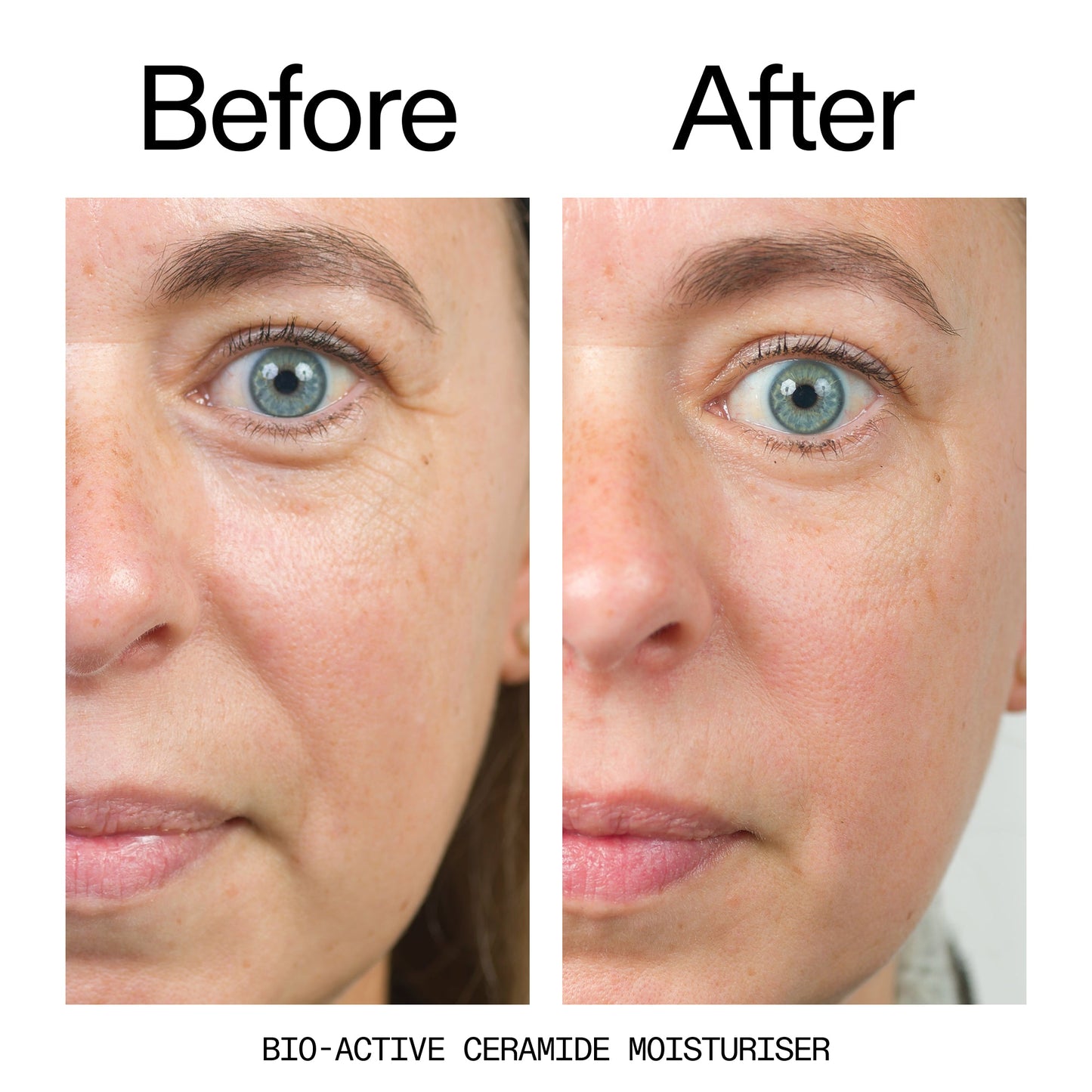 barrier-boosting-trio-t1 Bio-Active_Before_After_2000x2000_600947b4-e8c5-425a-9155-fc15bc83aa12.jpg
