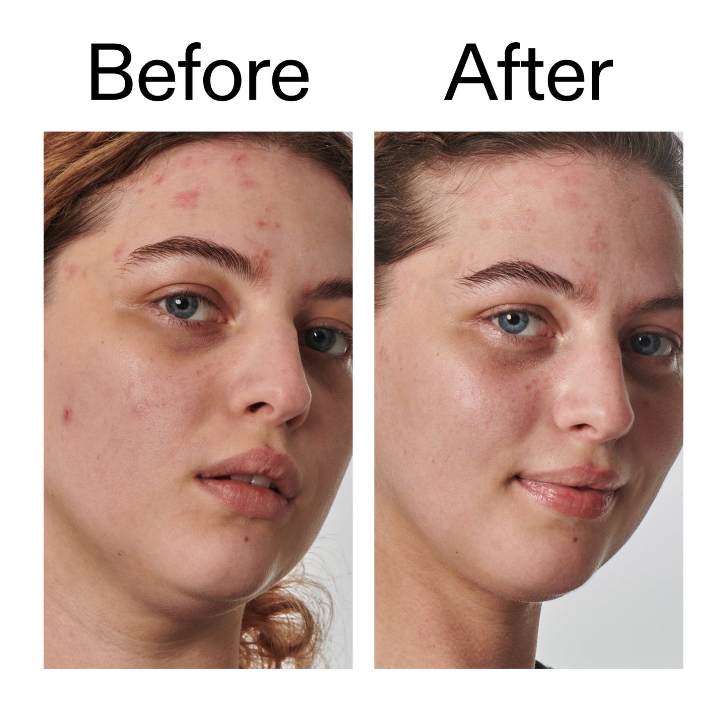10-urea-moisturizer-j5 Dry_and_Rough_Skin_Solution_Before_After_2000x2000_efa6e639-5c39-49bd-a5dd-f0220293120a.jpg