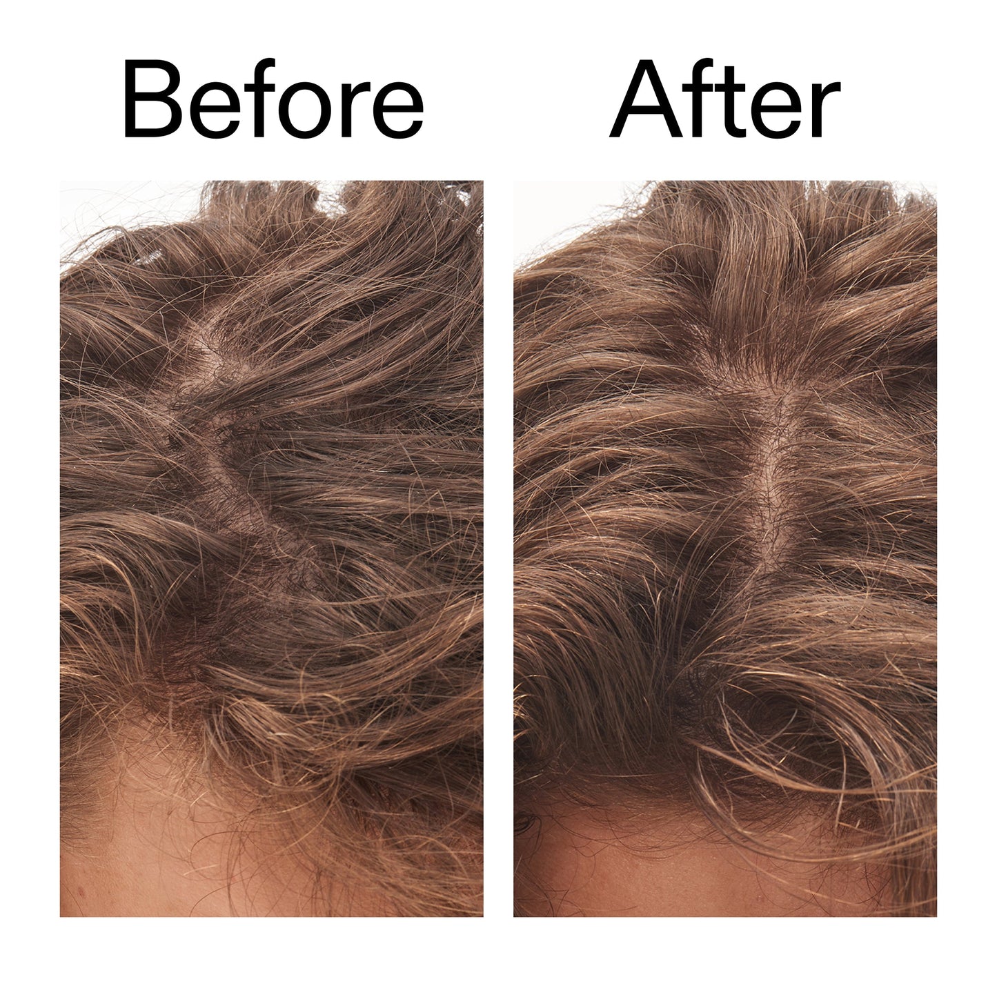 glycolic-acid-exfoliating-scalp-scrub-e2 Glycolic_Acid_Exfoliating_Scalp_Scrub_Before_After_2000x2000_b8561c87-05a1-4caa-80f7-1b6b33d750f7.jpg