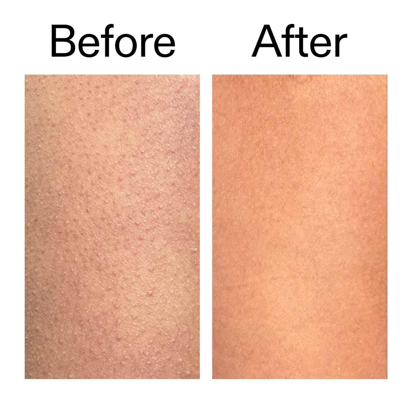 glycolic-acid-exfoliating-body-stick-duo-b1 Glycolic_Body_Stick_B_A_2000x2000_6e6e6b4d-5bd7-43c0-aeed-4d66788e8995.jpg