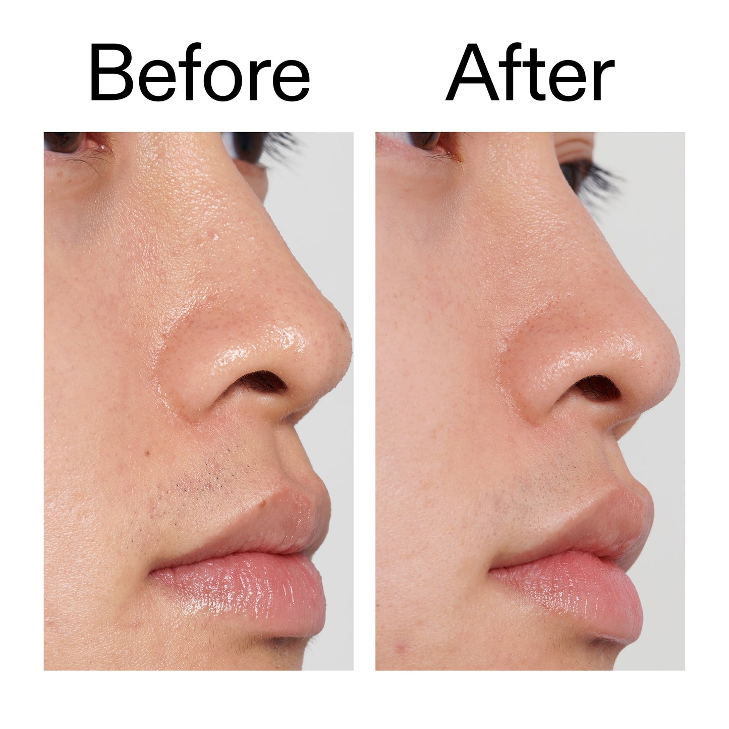 pha-toner-f9 PHA_Toner_Before_After_2000x2000_e3c10172-0150-4342-8b95-57417eaff50d.jpg