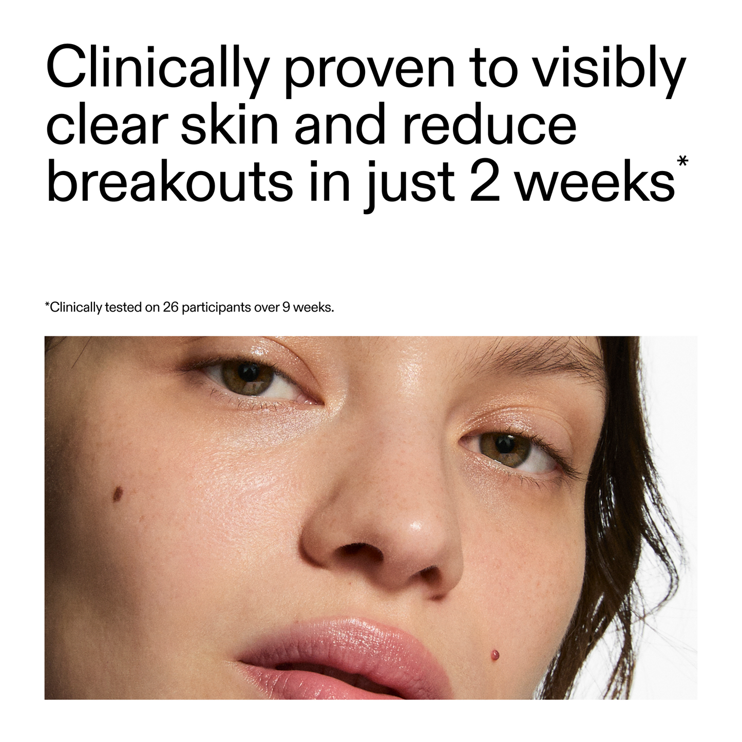 360-acne-clearing-duo-p1 360_Serum_Key_Claim.png