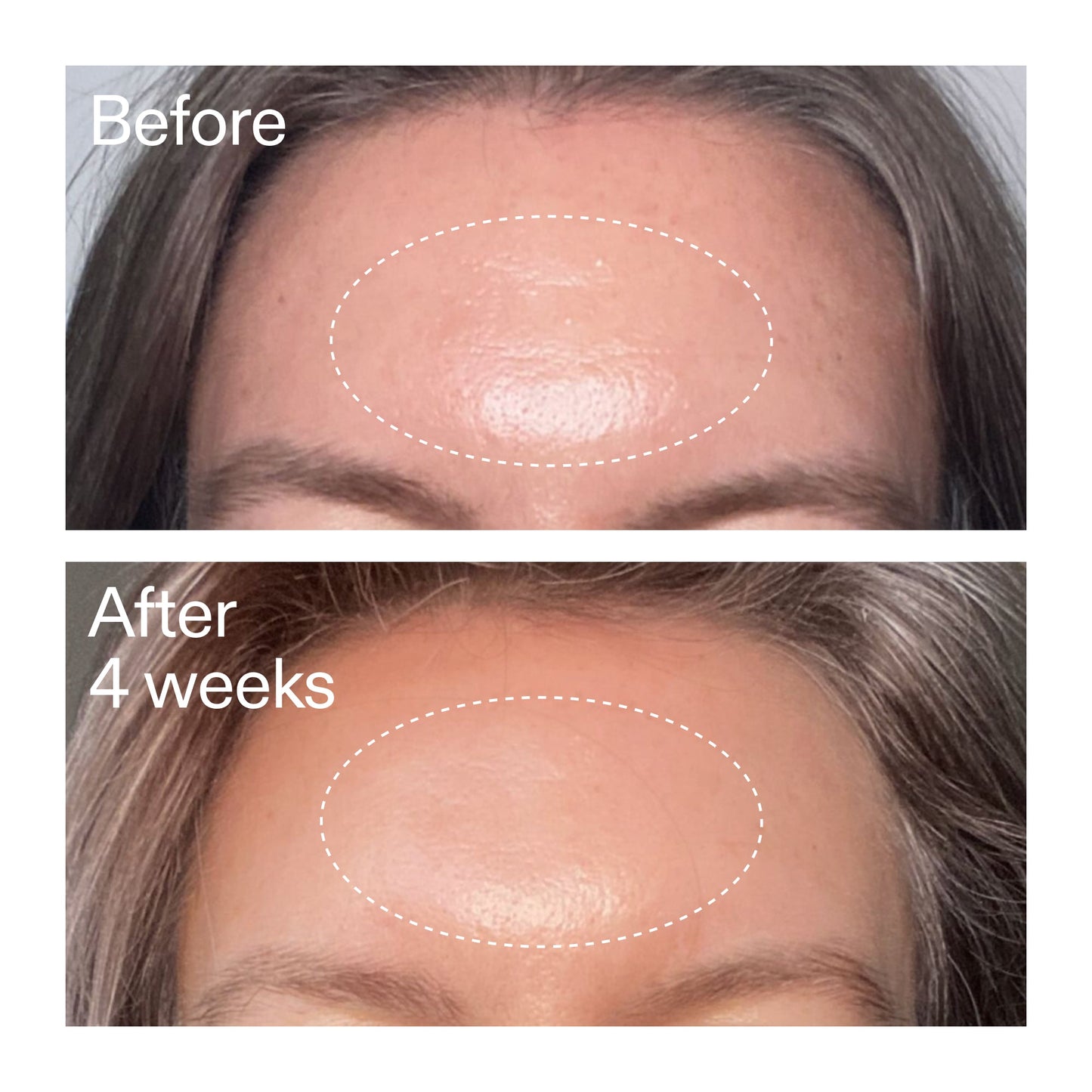 advanced-0-2-retinal-serum-g2 AdvancedRetinal_BeforeAfter1_2000x2000_1da6bb0a-29dd-41d1-95b7-8679696bbf0f.jpg