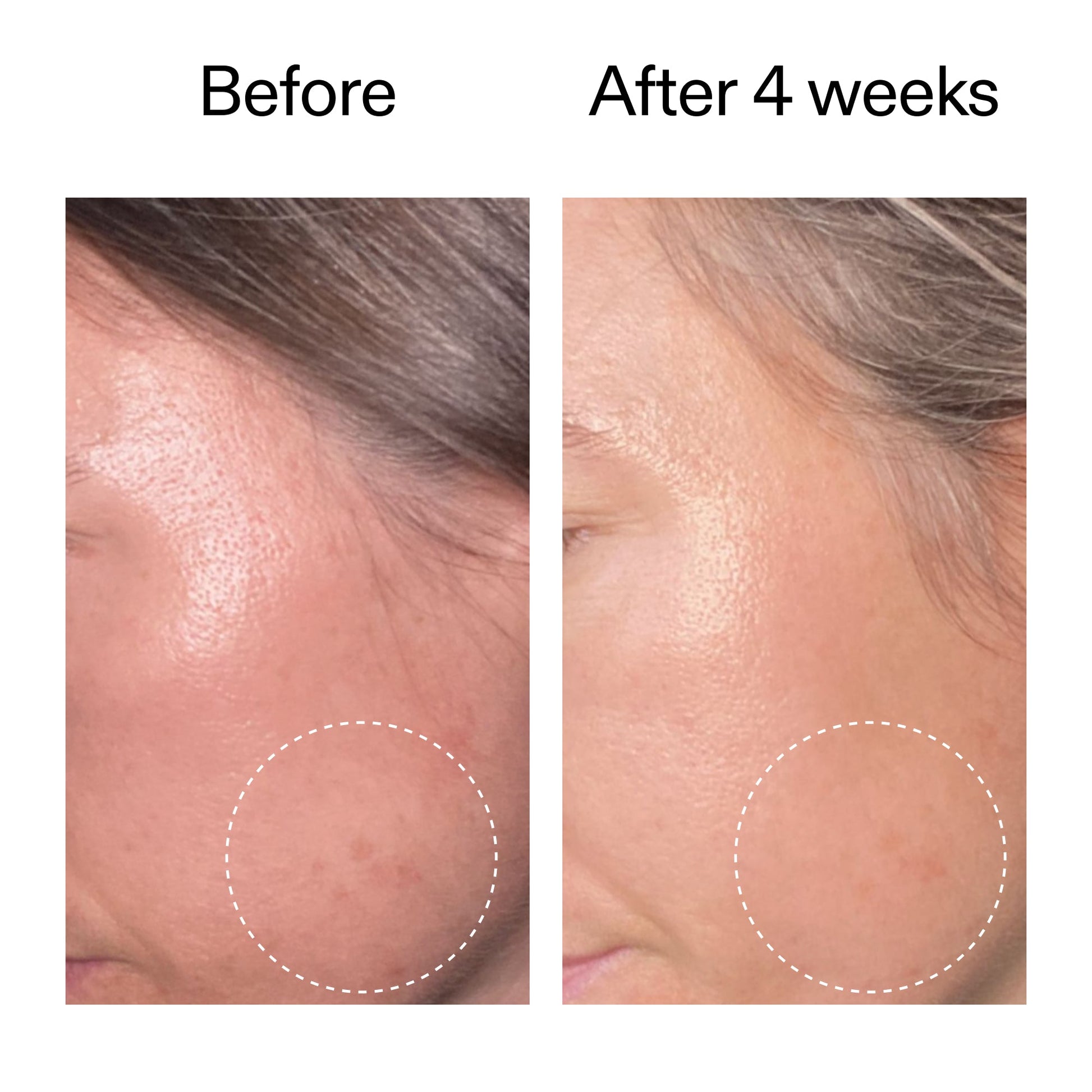 advanced-0-2-retinal-serum-g2 AdvancedRetinal_BeforeAfter2__2000x2000_62fb16bb-77ae-4d63-8500-88dbf847f4b9.jpg