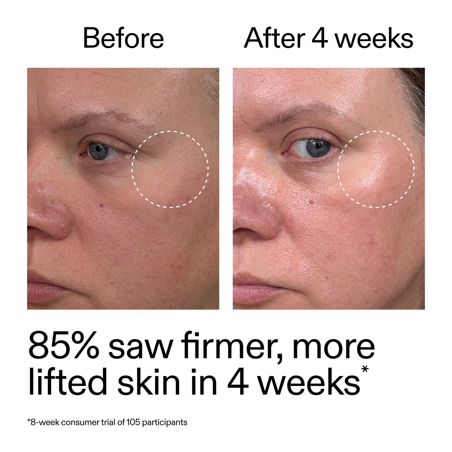 advanced-0-2-retinal-serum-duo-d3 AdvancedRetinal_BeforeAfter_Claim1_2000x2000_3a315aa8-f408-4b33-bbeb-0d9209f98404.jpg
