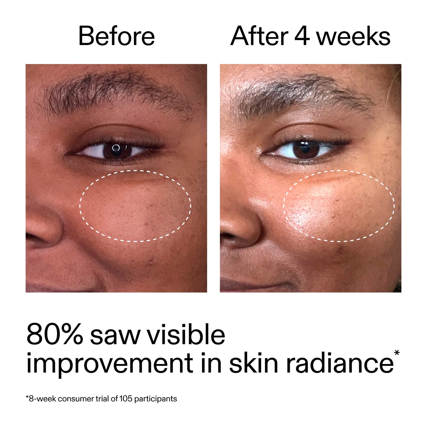 advanced-0-2-retinal-serum-g2 AdvancedRetinal_BeforeAfter_Claim2_2000x2000_39d11e3d-eda9-44ec-ab32-2903b1a368bd.jpg