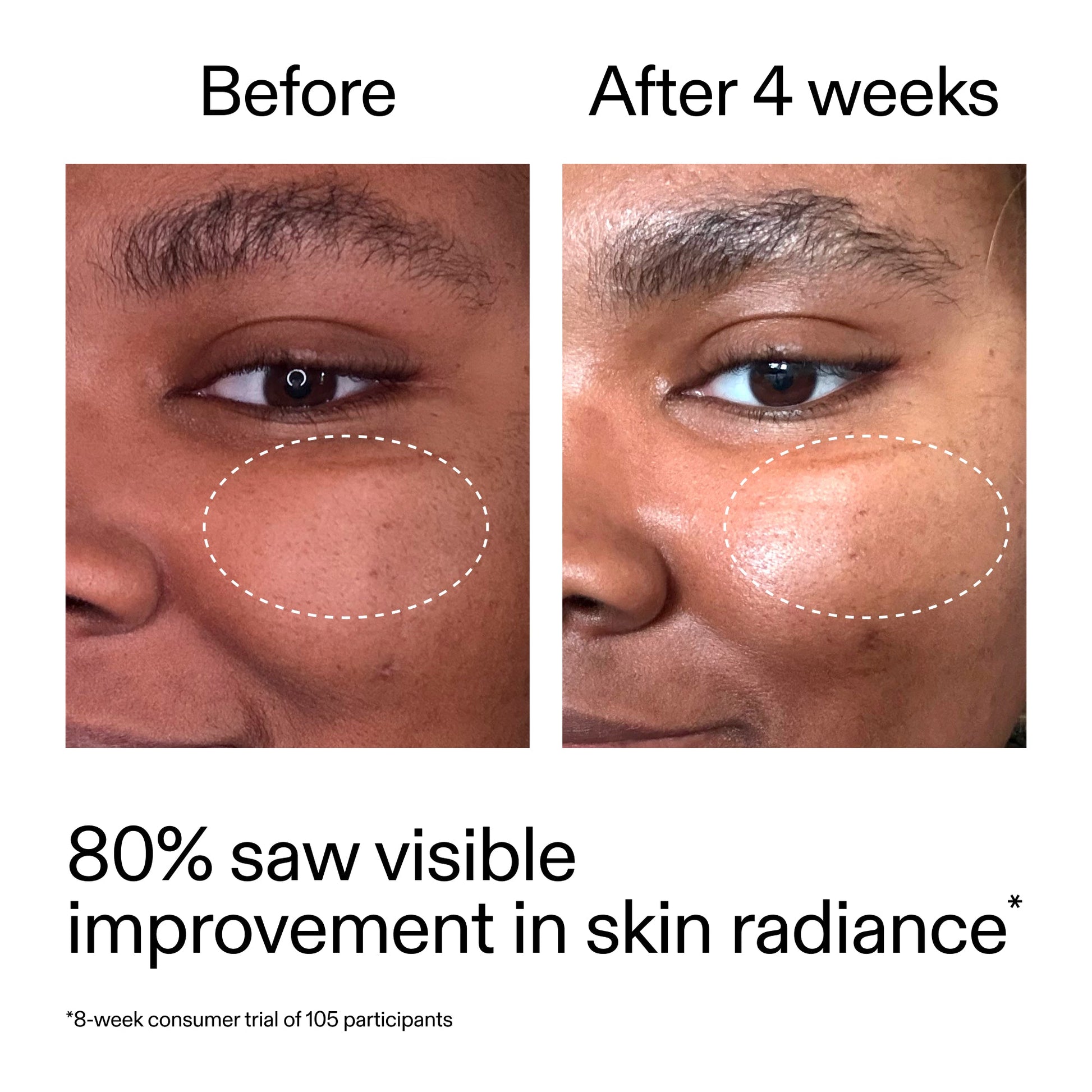 advanced-0-2-retinal-serum-duo-d3 AdvancedRetinal_BeforeAfter_Claim2_2000x2000_681b621d-8d44-4d44-9a40-89244f9b2e53.jpg