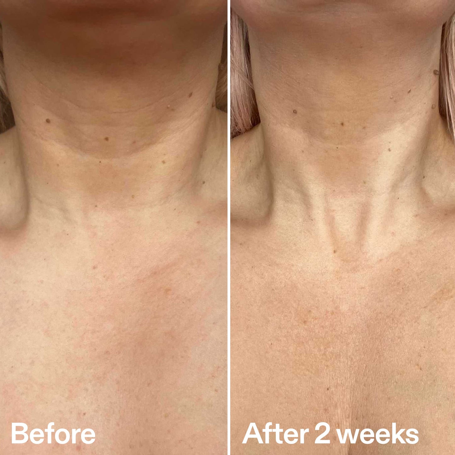 bio-active-neck-lift-stick-i5 B_A_2.jpg