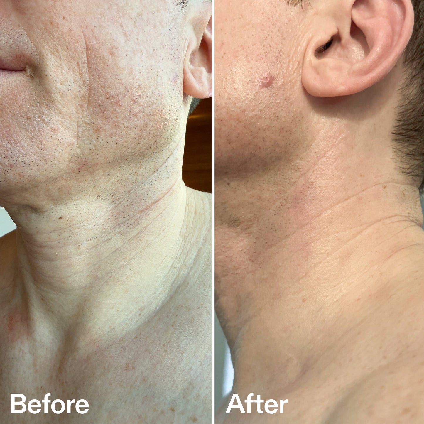 bio-active-neck-lift-stick-i5 B_A_afa2743e-b8e2-4504-92f4-e281cb6cf759.jpg