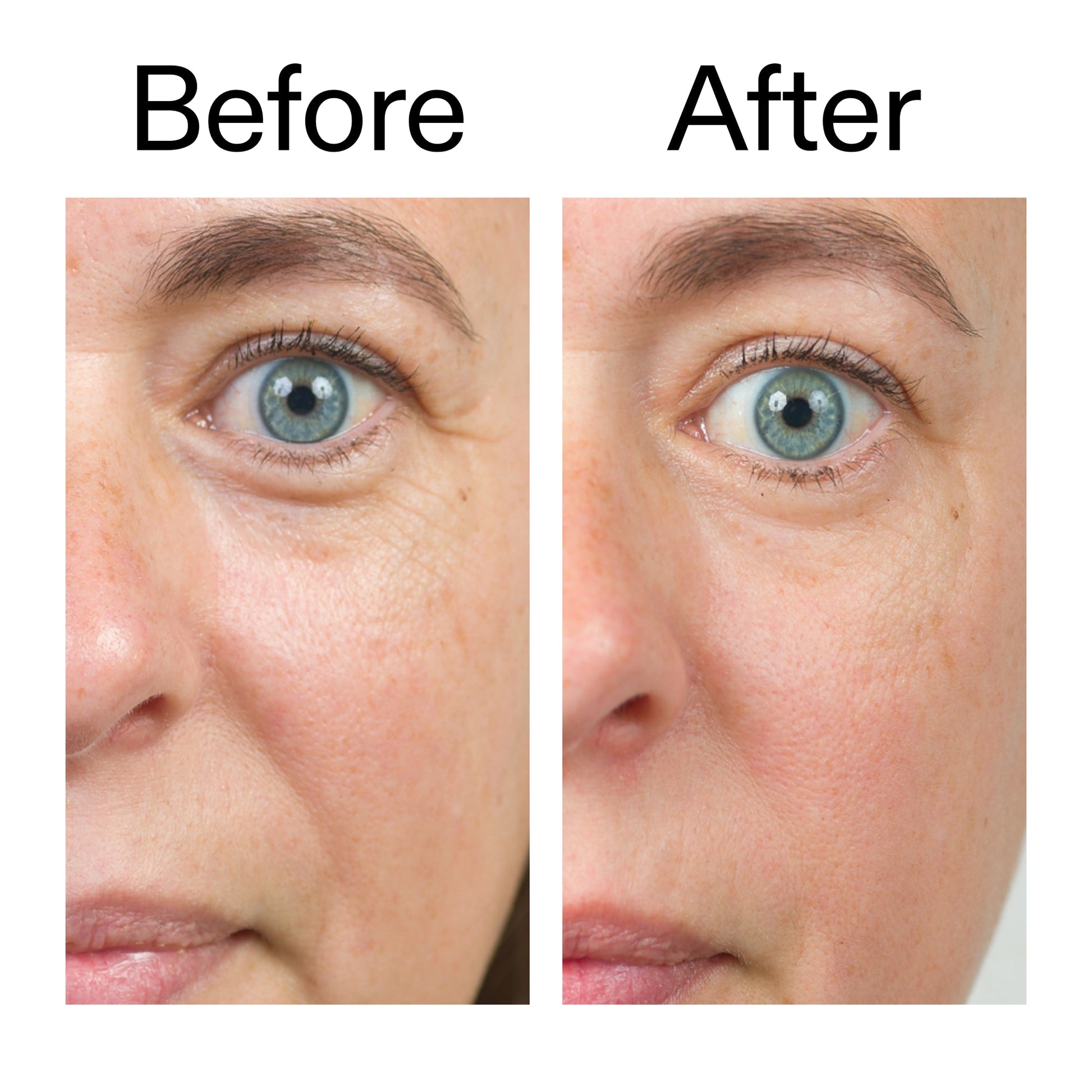 bio-active-ceramide-moisturizer-m2 Bio-Active_Before_After_2000x2000_566e5a9e-135e-417a-8242-b44e5fa35463.jpg