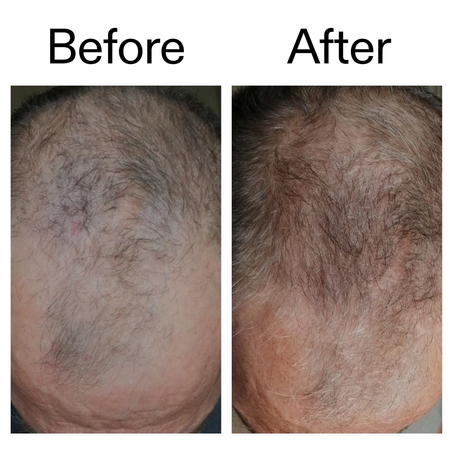 3-month-hair-growth-trio-q4 Caffeine_Scalp_Treatment_B_A_Ppage_2000_x_2000.jpg