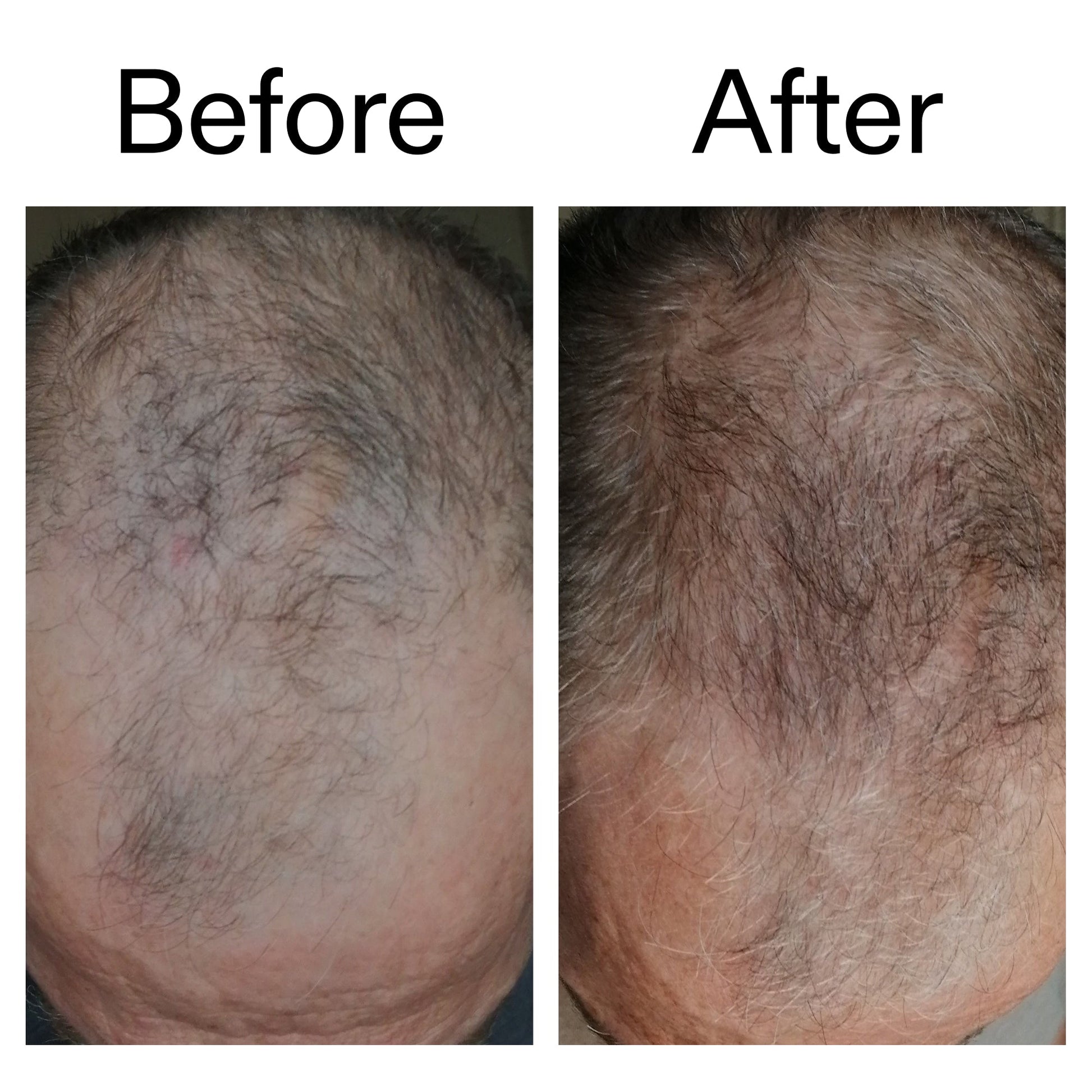 3-month-hair-growth-trio-q4 Caffeine_Scalp_Treatment_B_A_Ppage_2000_x_2000.jpg