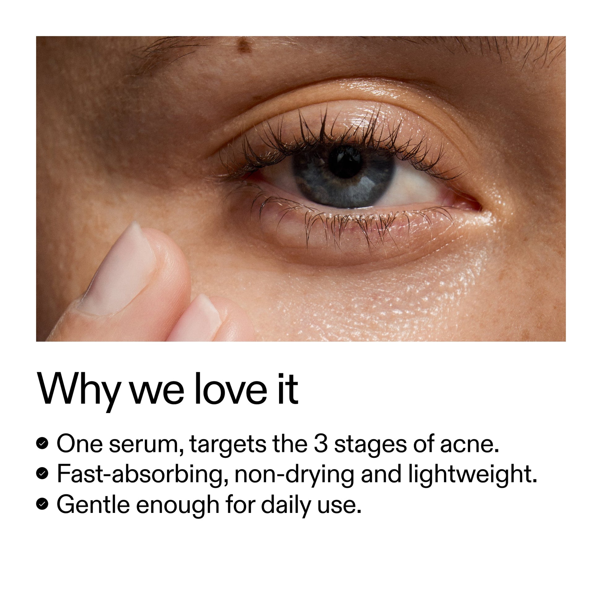 360-acne-clearing-serum-z2 Dioic_Whyweloveit_2000x2000_175aafd3-0cbe-403a-b317-a8362881bfe2.jpg