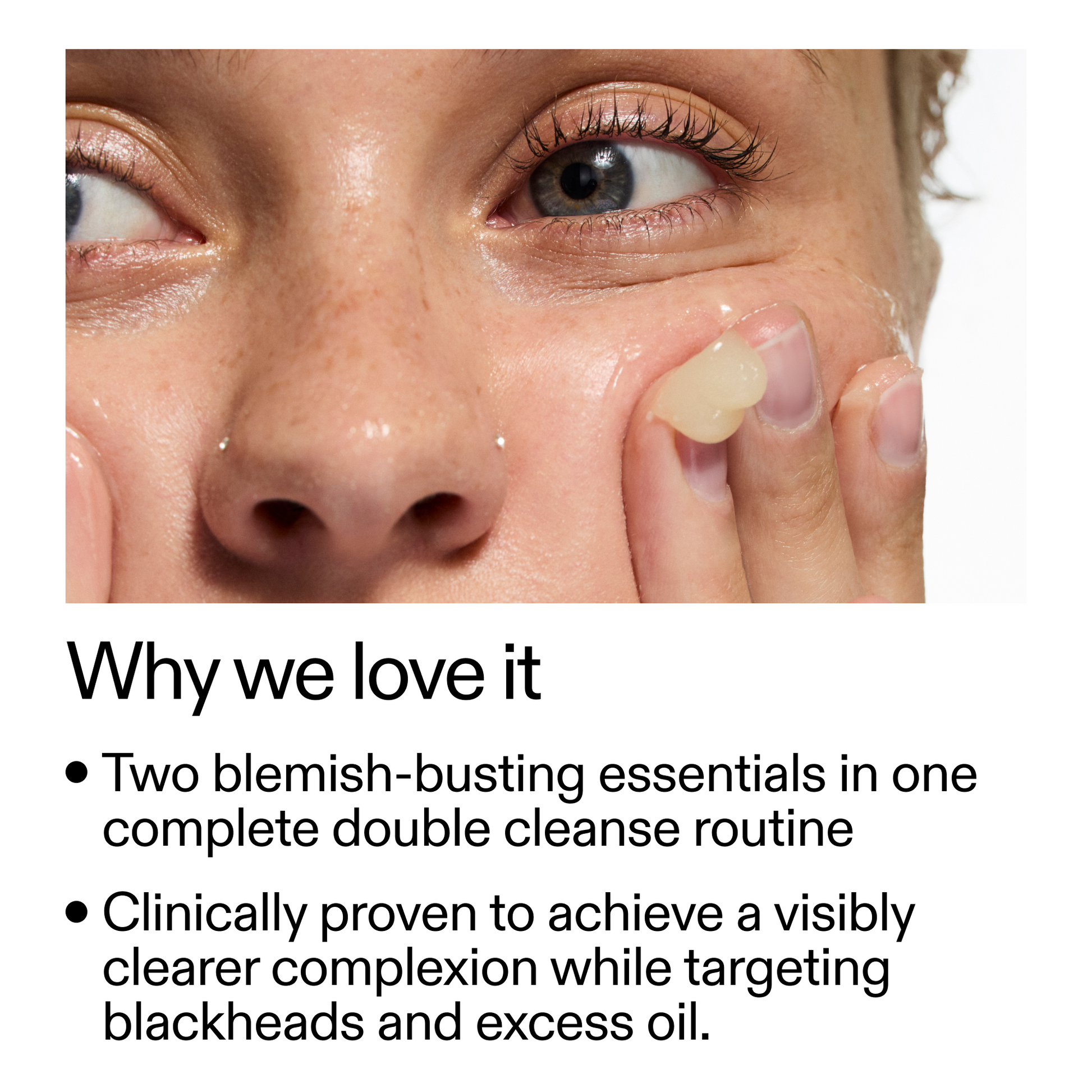 acne-double-cleanse-duo-w3 Double_Cleanse_Duo_for_Breakouts_Why_We_2000x2000_f242cb12-bb5c-487c-b203-071ccb406ec5.png