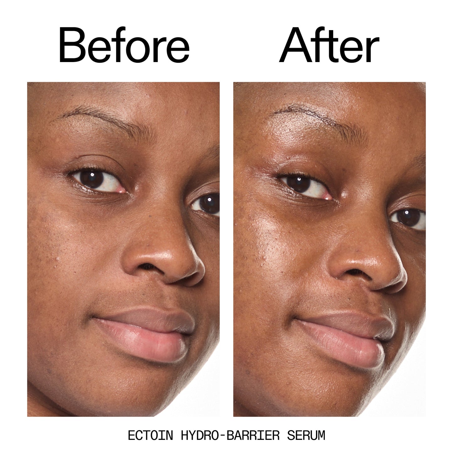 barrier-boosting-trio-t1 Ectoin_Before_After_2000x2000_ce35bc41-4da0-4b6f-adc7-29f8641f6c6c.jpg