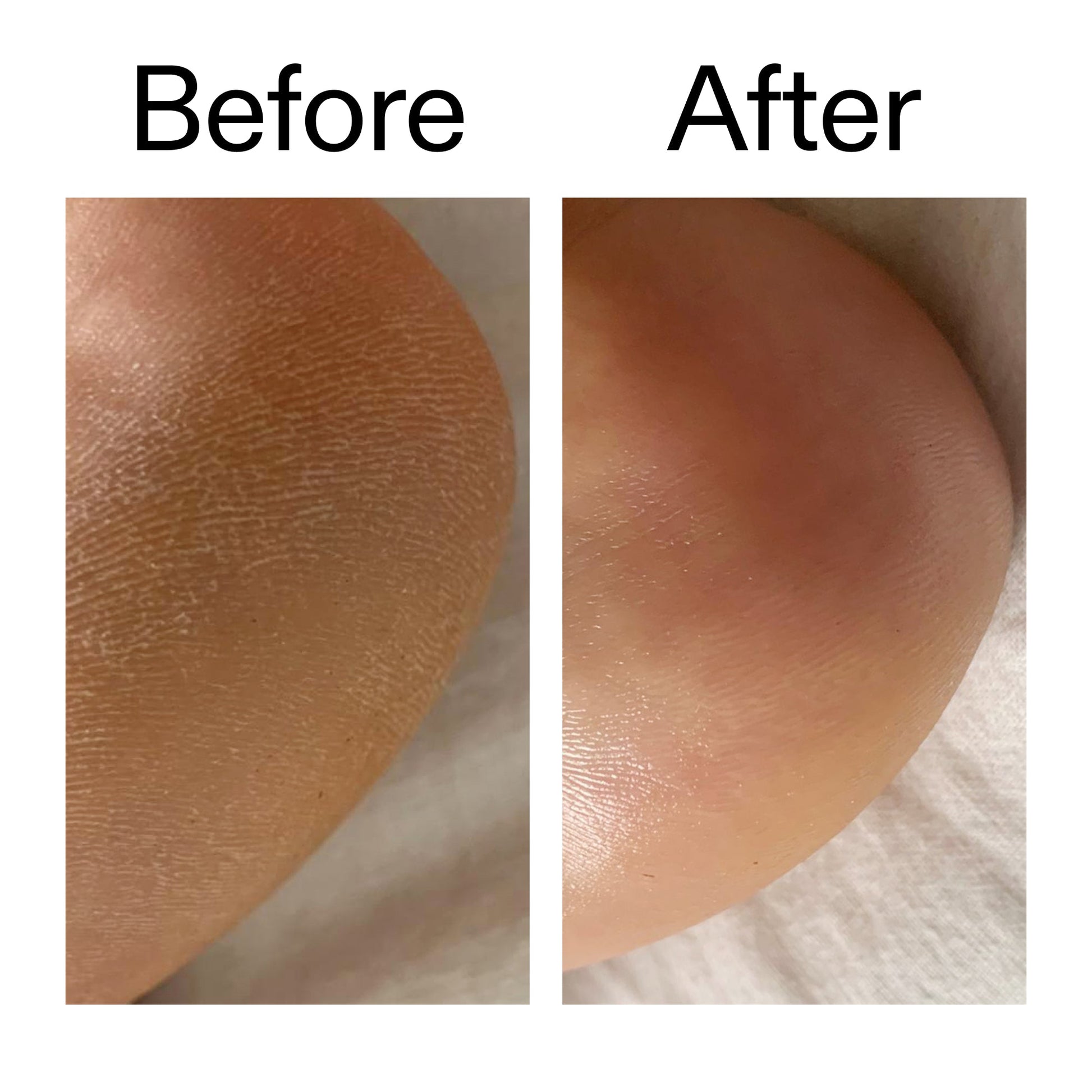 glycolic-acid-exfoliating-body-stick-x5 Glycolic_Acid_Exfoliating_Body_Stick_Before_After_V1_2000x2000_a3043625-9400-429a-a7fb-d6dbd220f722.jpg