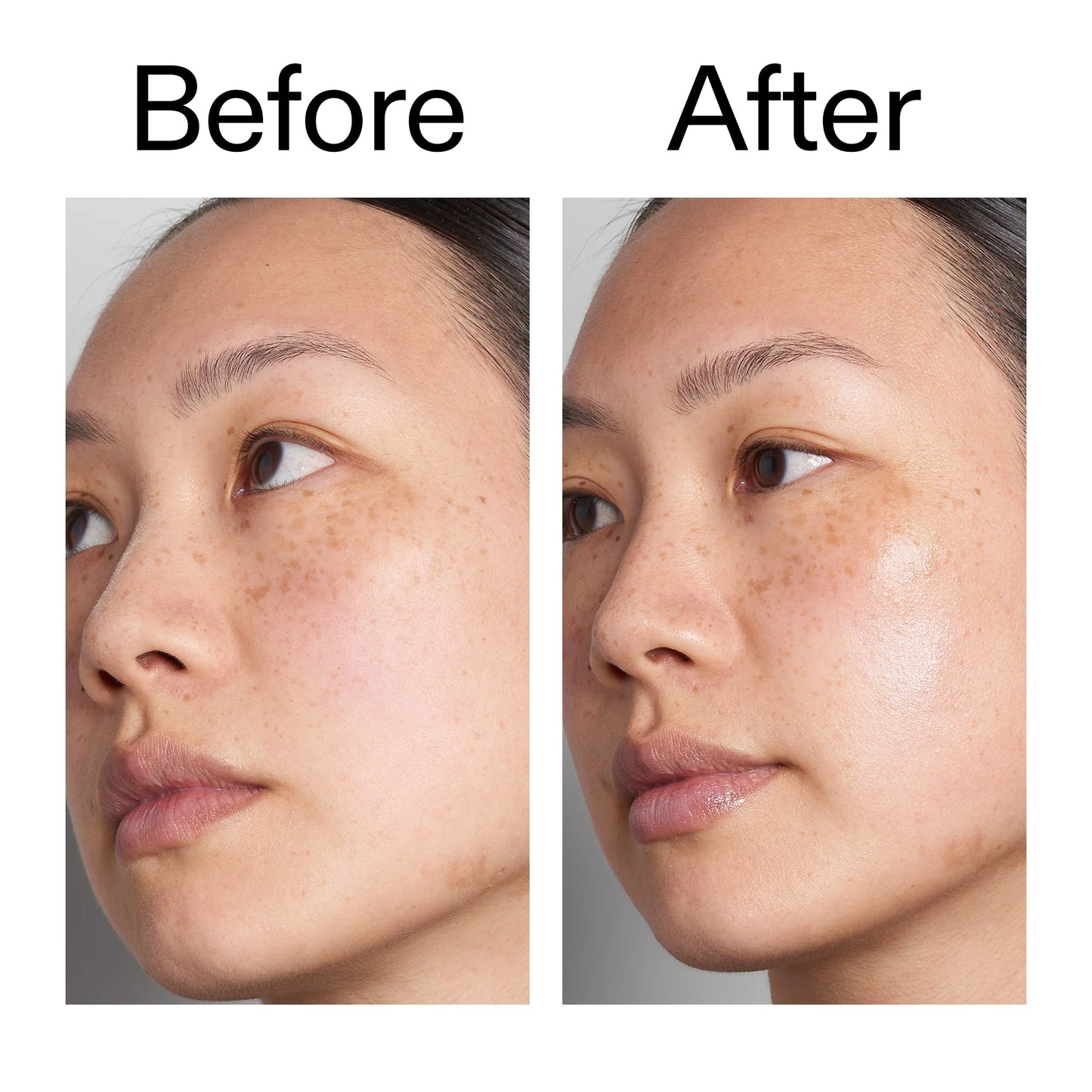 hyaluronic-acid-serum-60ml-duo-r6 Hyaluronic_Acid_Before_After_2000x2000_d566f5ba-a77e-4585-99fd-0f4682b164dd.jpg
