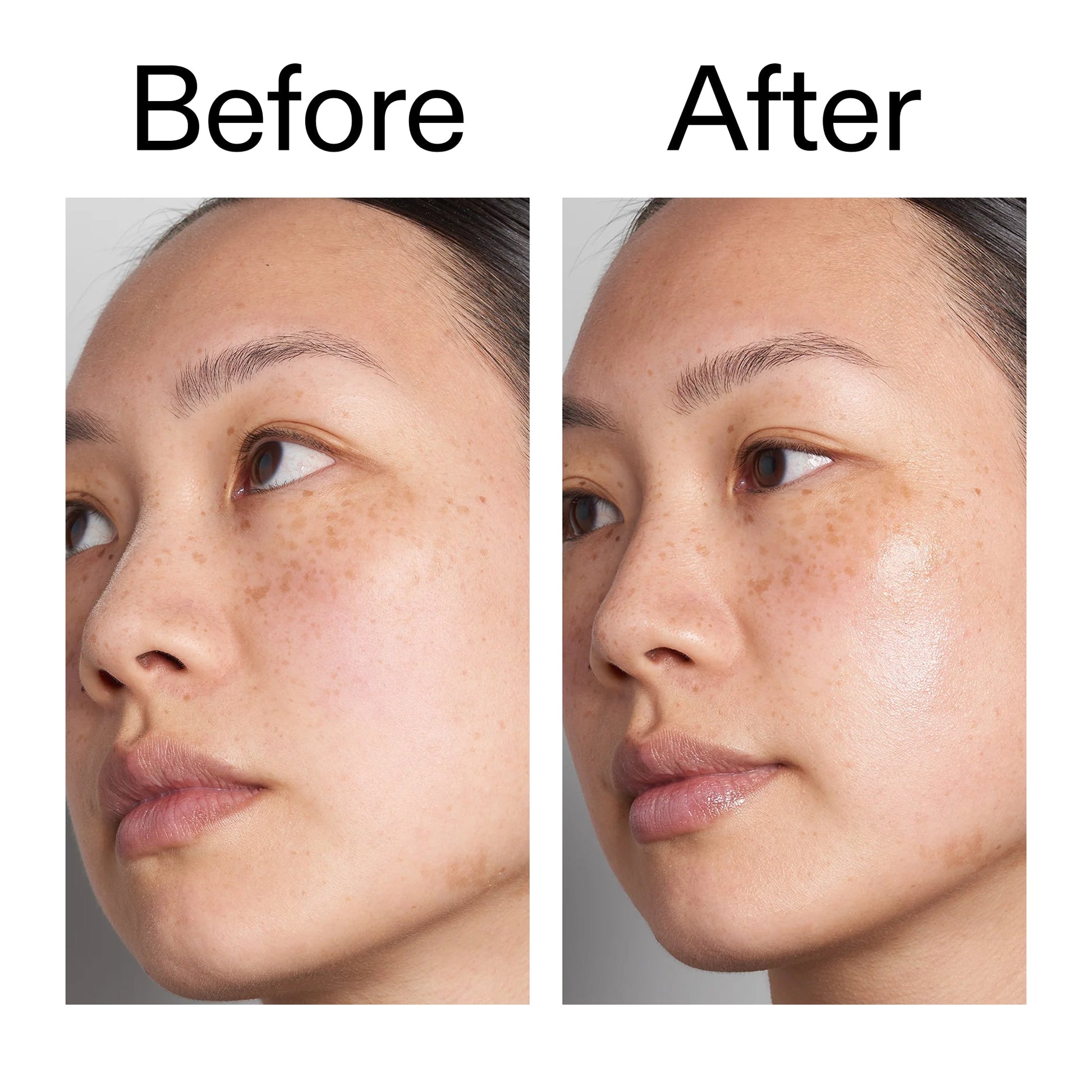 supersize-hyaluronic-acid-serum-100ml-duo-m4 Hyaluronic_Acid_Before_After_2000x2000_d7983956-8aa2-4ea3-8255-c63e8d4f892e.jpg