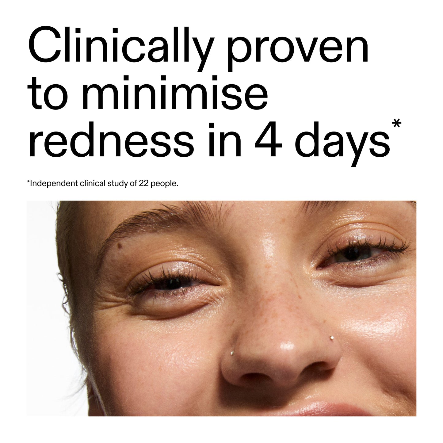 10-azelaic-acid-serum-for-redness-relief-x3 Oat_Cleansing_Balm_Claim_2000x2000_52a841dc-353c-4f2c-8646-3aadb604507d.jpg