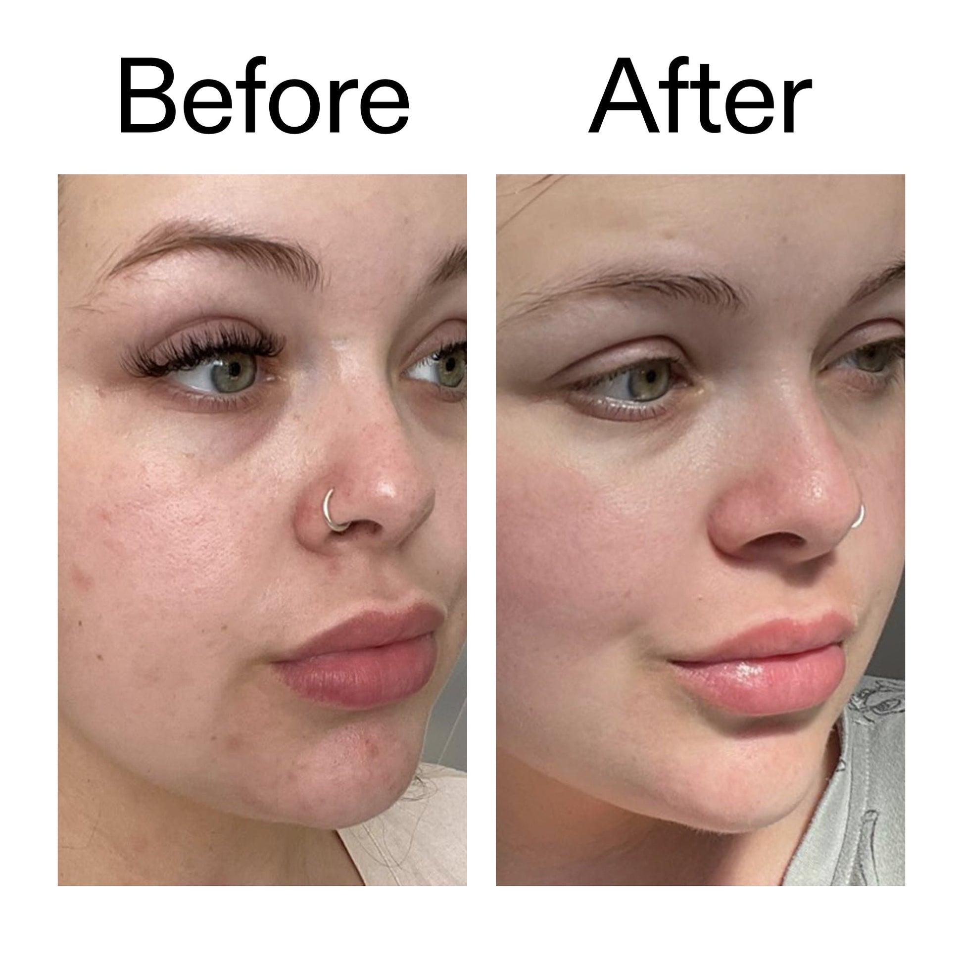 omega-water-cream-50ml-h2 Omega50_Before_After_2000x2000_46483ed8-3f9d-487f-9a0c-9df79830bd65.jpg