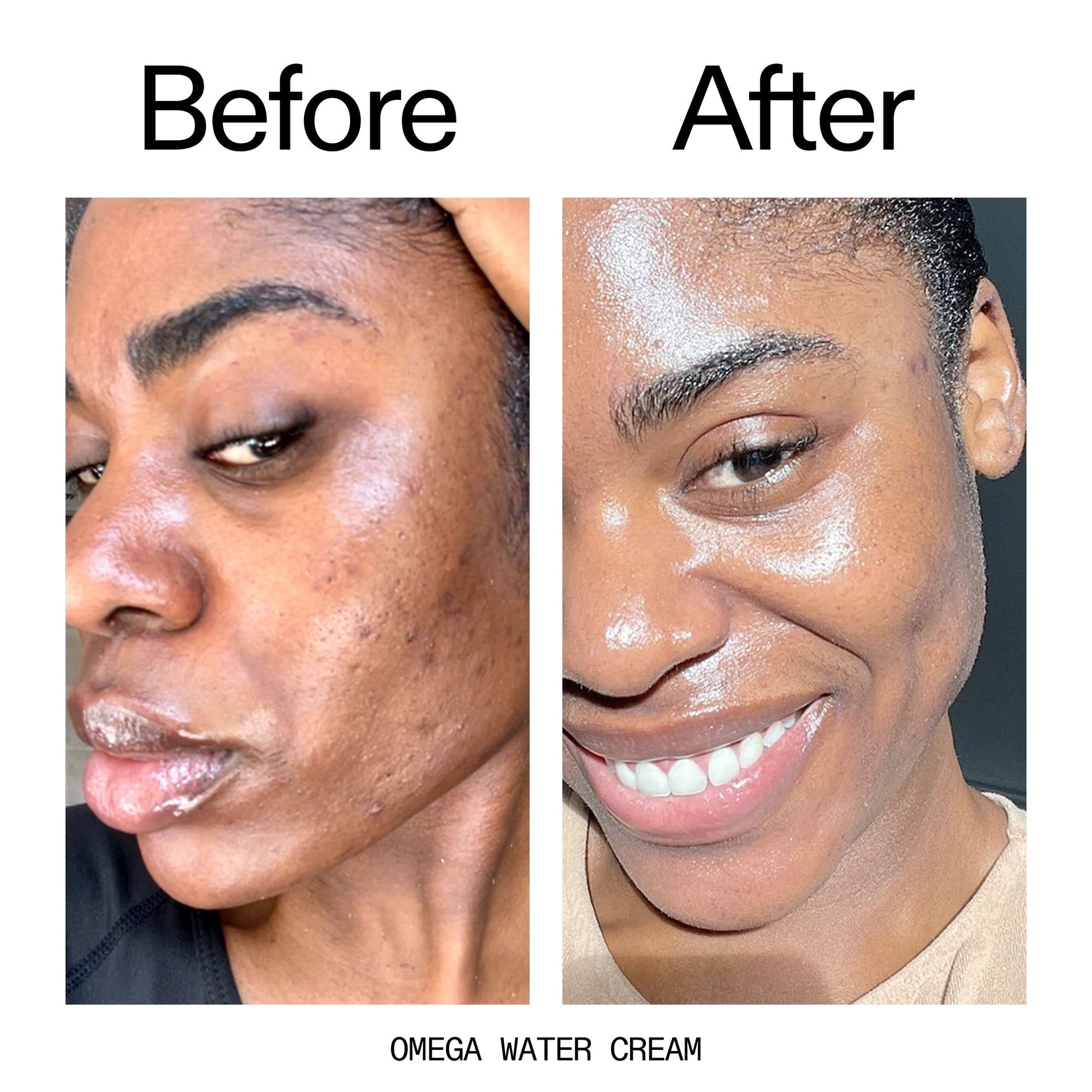 glowing-skin-set-s0 Omega_Water_Cream_Before_After_2000x2000_8e88278b-8c8d-48dc-ac77-4e98ebbd1b77.jpg