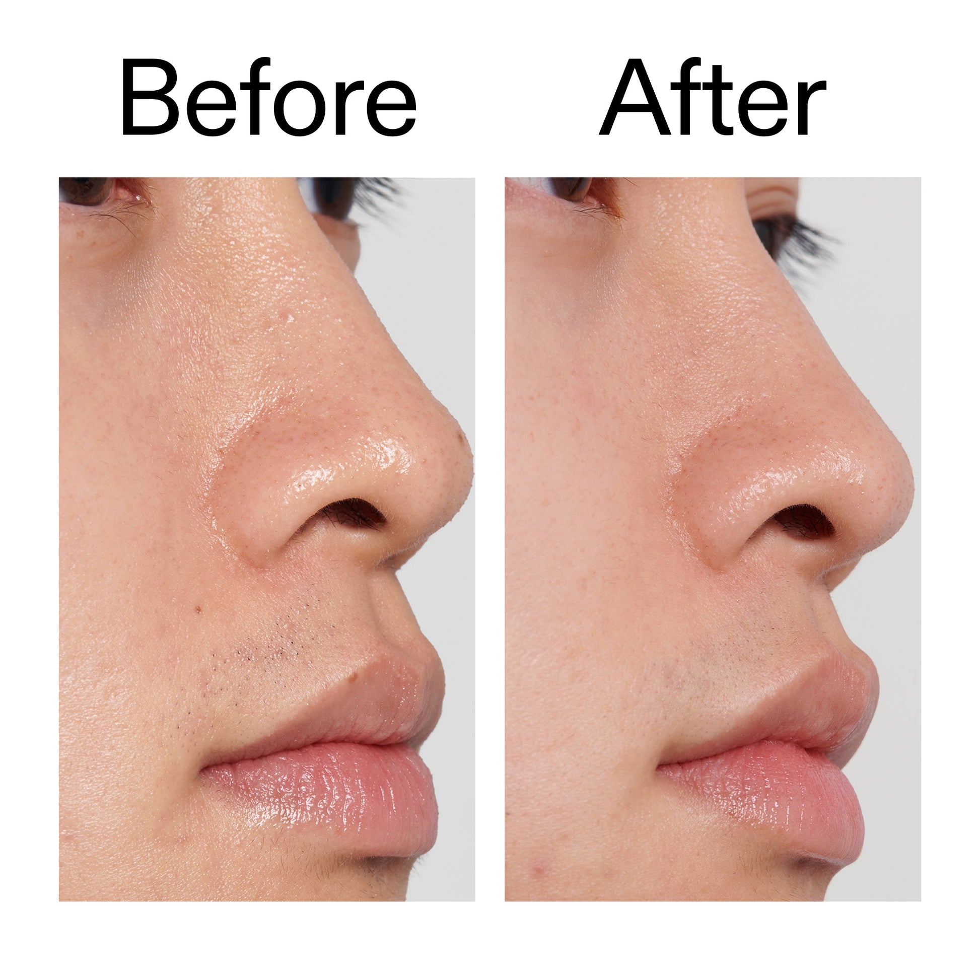 pha-toner-f9 PHA_Toner_Before_After_2000x2000_e3c10172-0150-4342-8b95-57417eaff50d.jpg