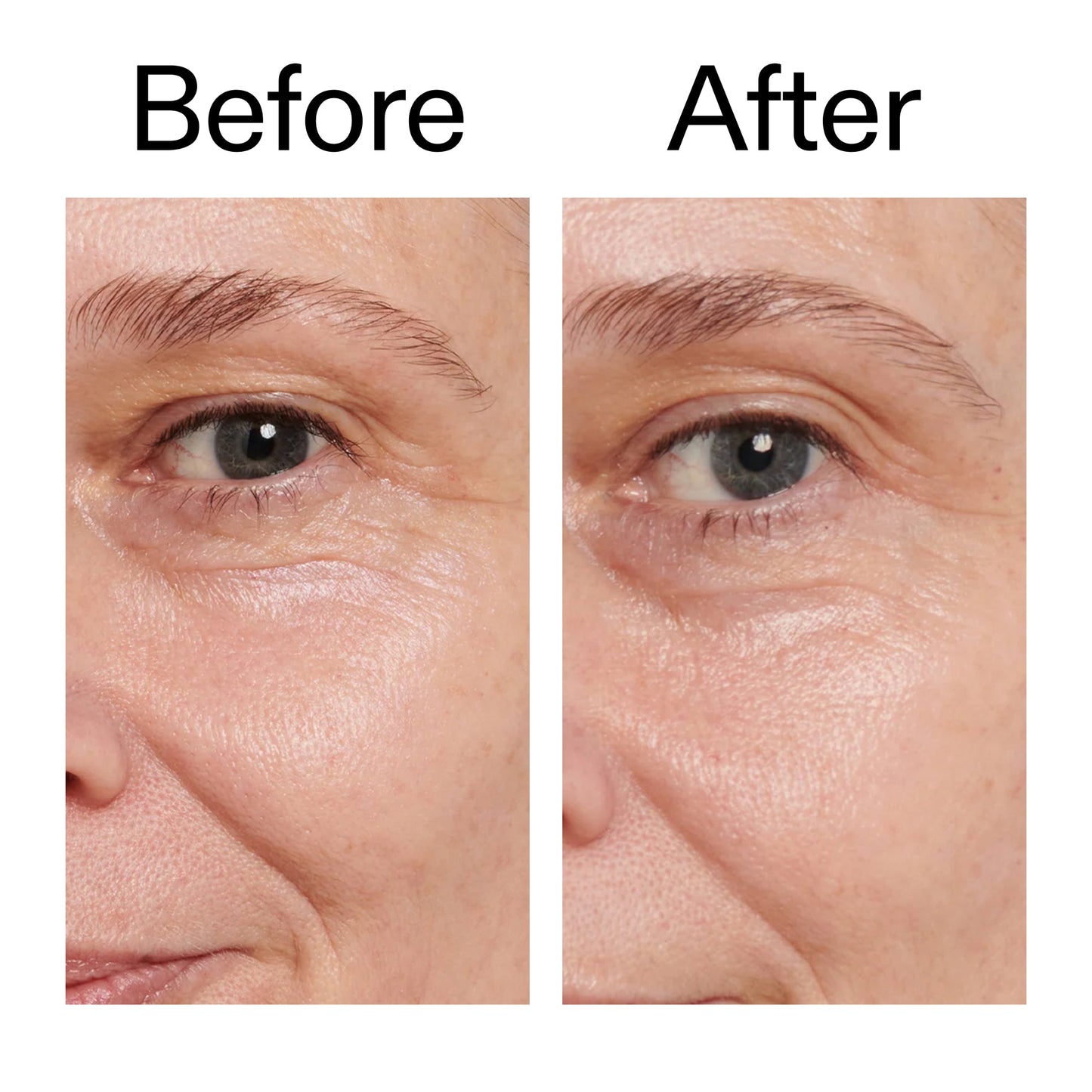retinol-eye-cream-j9 Retinol_Eye_Cream_Before_After_2000x2000_ac03a80c-109e-4572-a95a-91dc109b4d27.jpg