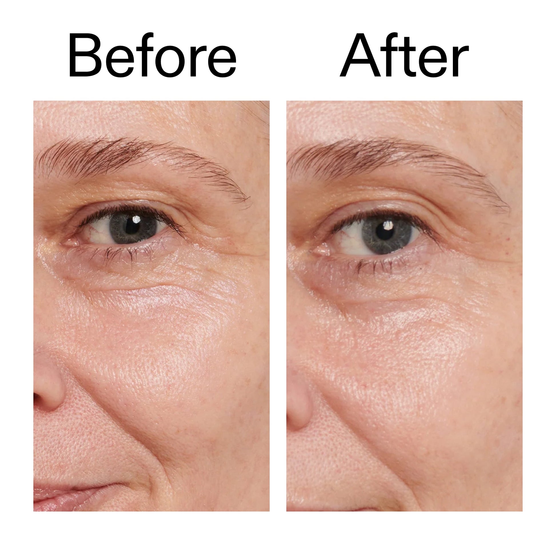 retinol-eye-cream-j9 Retinol_Eye_Cream_Before_After_2000x2000_ac03a80c-109e-4572-a95a-91dc109b4d27.jpg