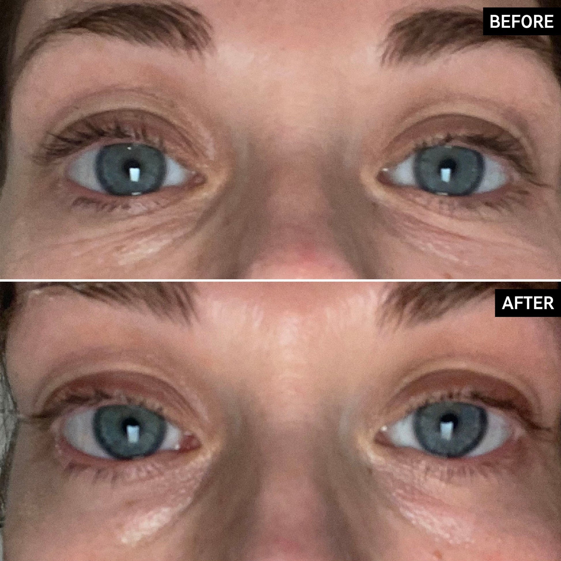 retinol-eye-cream-j9 SITE-UGCBAsApril_Nicole_B_A_PPage_2000x2000_1.jpg