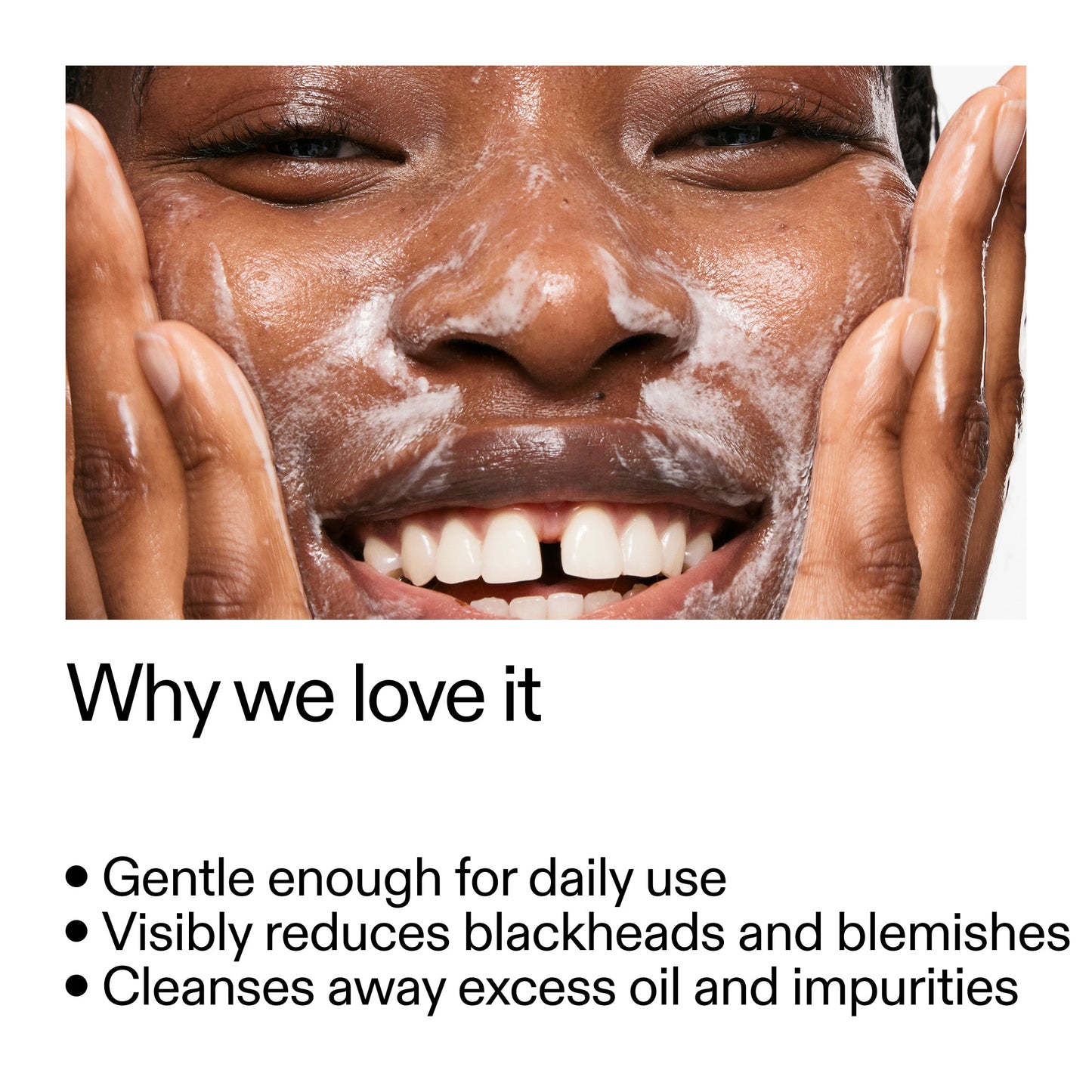 salicylic-acid-cleanser-duo-k5 Salicylic_Acid_Cleanser_-_300mlWhy_we_love_it_2000x2000_87dc92a9-2559-4309-98cd-4e570f1be735.jpg