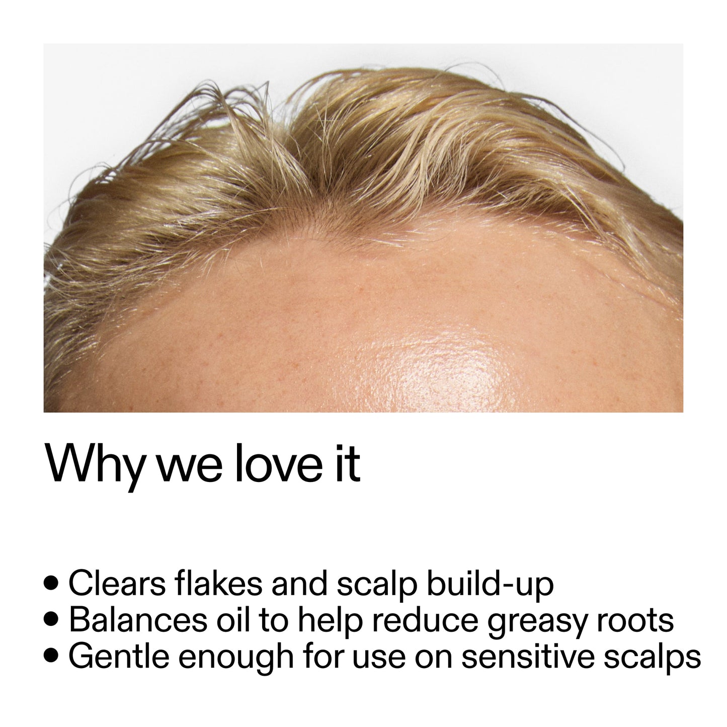 salicylic-acid-exfoliating-scalp-treatment-i8 Salicylic_Acid_Exfoliating_Scalp_Treatment_Why_we_love_it_2000x2000_44b6bd6d-9ec4-4b23-9dc4-bc3fd6f28e14.jpg