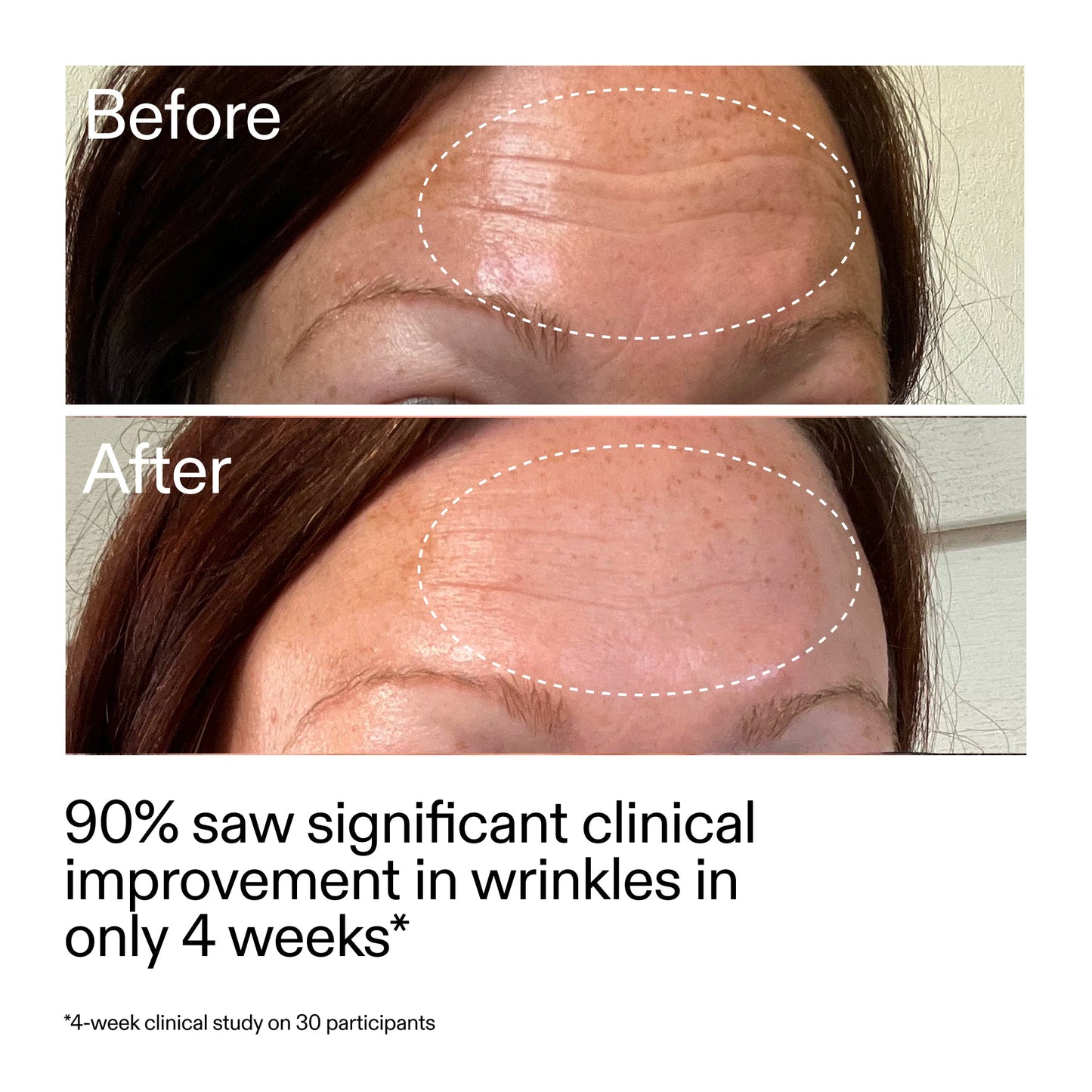 starter-retinol-serum-k0 StarterRetinol_BeforeAfter_Claim1_2000x2000_a09b50b6-4688-4527-abae-21bd142b89b7.jpg