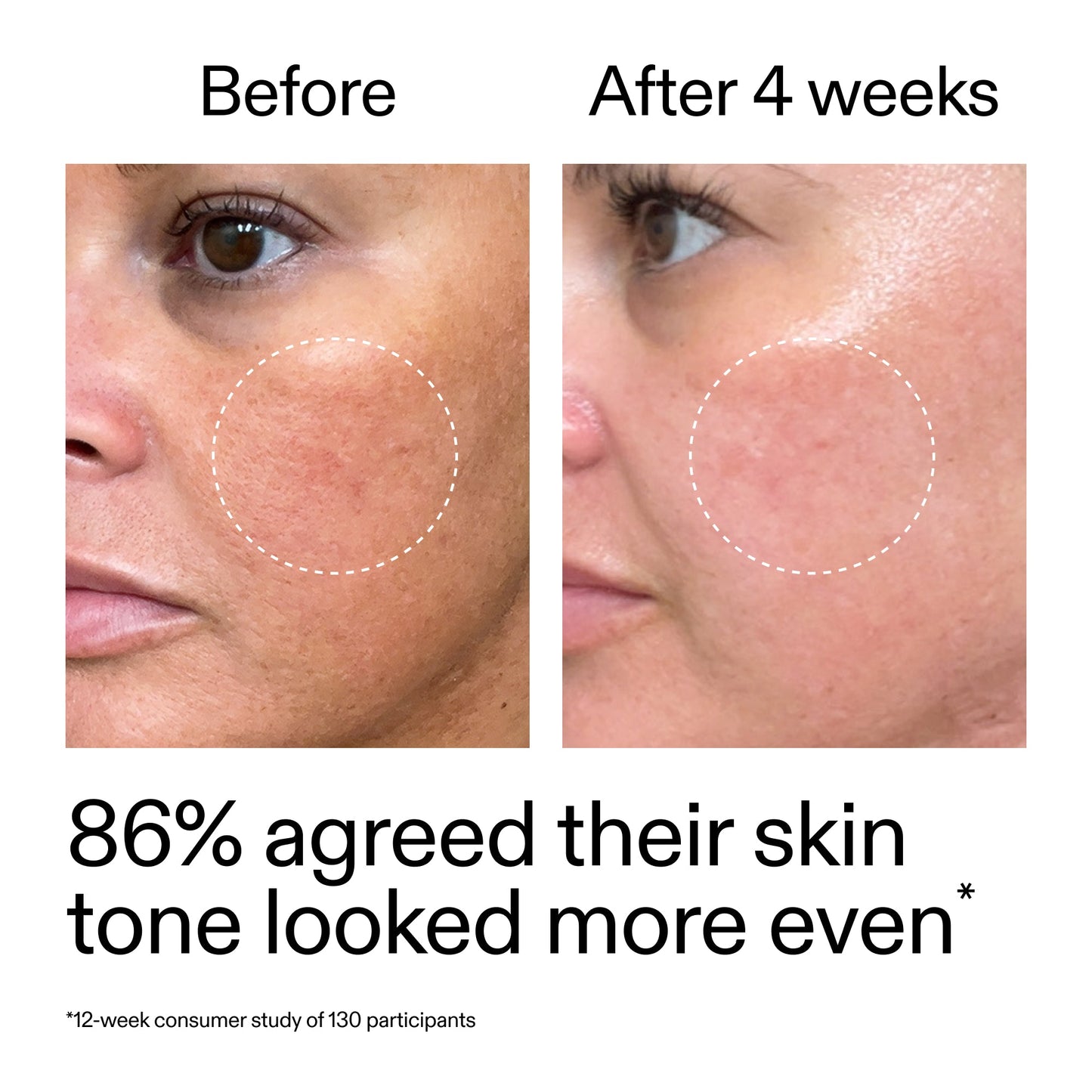 starter-retinol-serum-duo-x4 StarterRetinol_BeforeAfter_Claim2_2000x2000_fc5bb8ac-8588-478f-98d5-28af6651601a.jpg