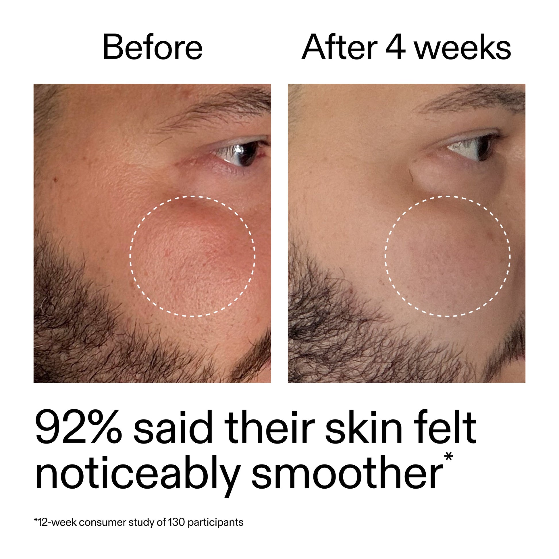starter-retinol-serum-duo-x4 StarterRetinol_BeforeAfter_Claim3_2000x2000_458243a8-bbb0-4e5d-a274-29c7766d339b.jpg