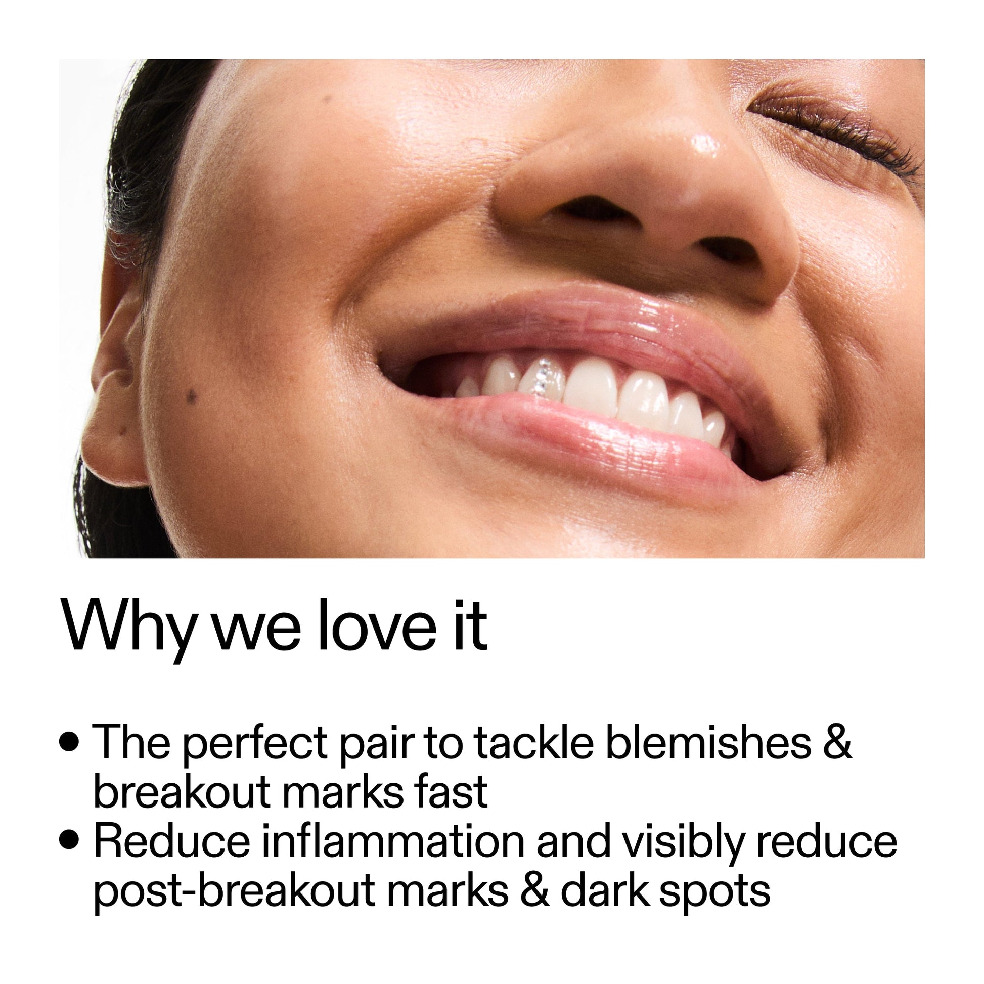 targeted-blemish-duo-z2 Targeted_Blemish_Duo_Why_we_love_it_2000x2000_ff00be46-438b-485f-b5c3-91e60bbb6919.jpg