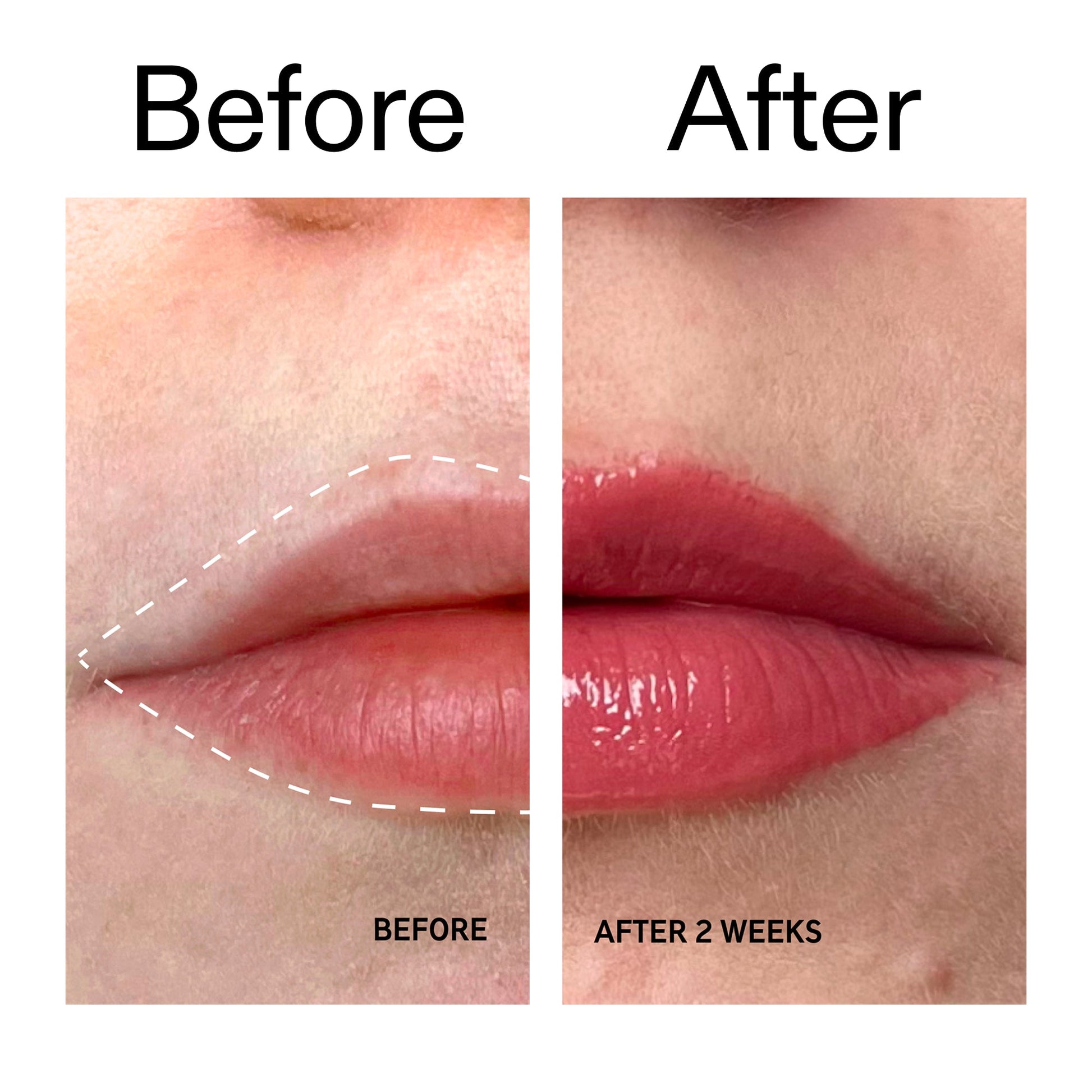 tripeptide-plumping-berry-lip-balm-r2 Tripeptide_Plumping_Lip_Balm_-_Berry_Before_After_2000x2000_9474bbd8-43ca-4b0e-b0e7-dfab70b91927.jpg