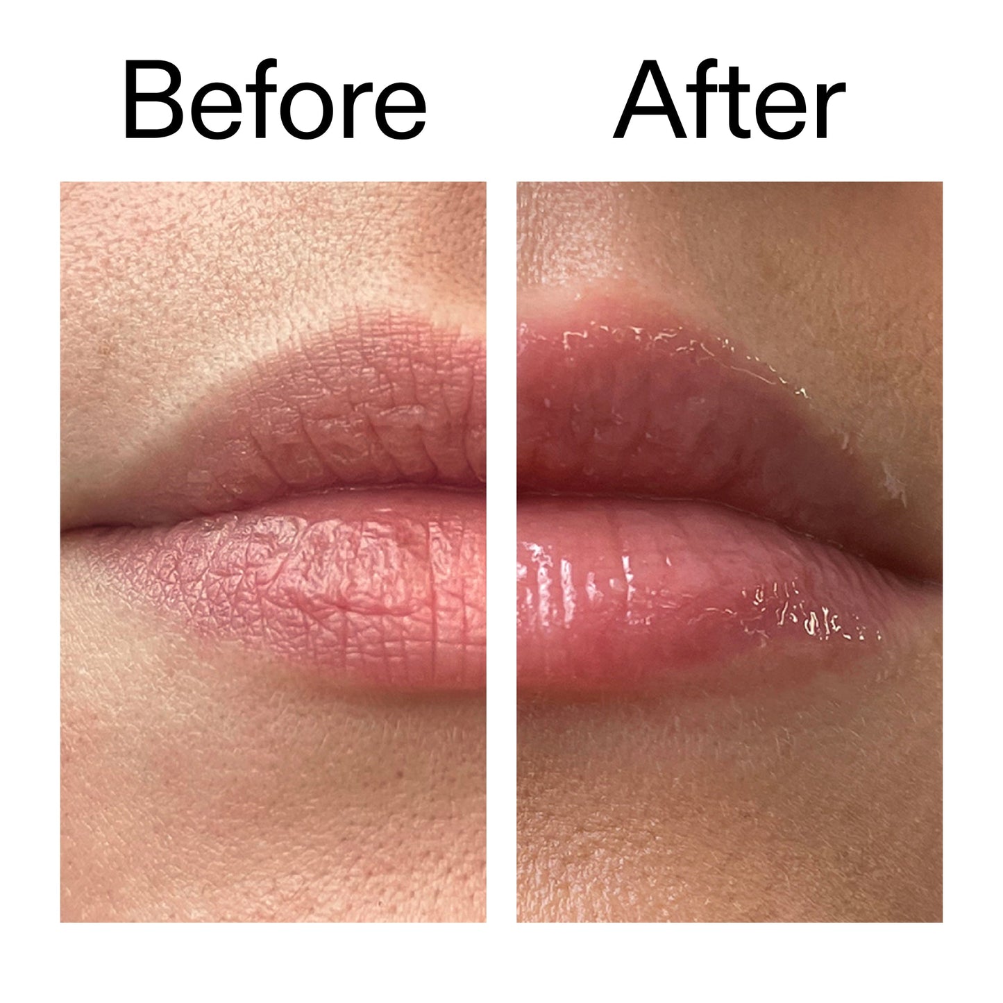 lip-plumping-duo-u5 Tripeptide_Plumping_Lip_Balm_Before_After_2000x2000_b4a5ee04-d2ac-4857-8f01-17209acc4bf3.jpg