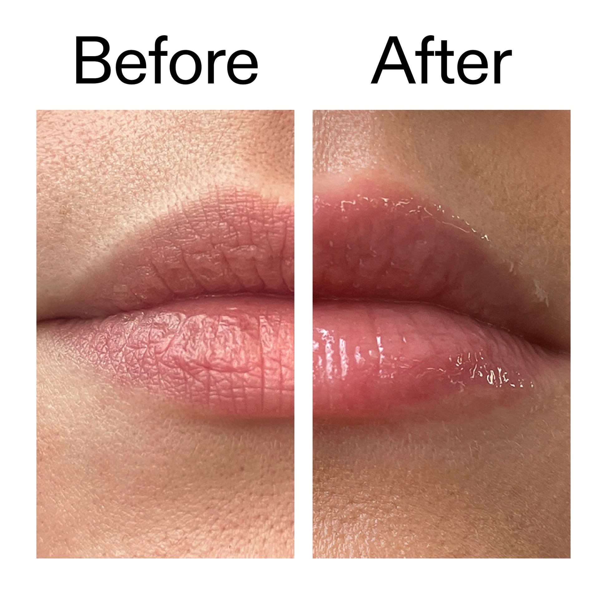 lip-plumping-duo-u5 Tripeptide_Plumping_Lip_Balm_Before_After_2000x2000_b4a5ee04-d2ac-4857-8f01-17209acc4bf3.jpg