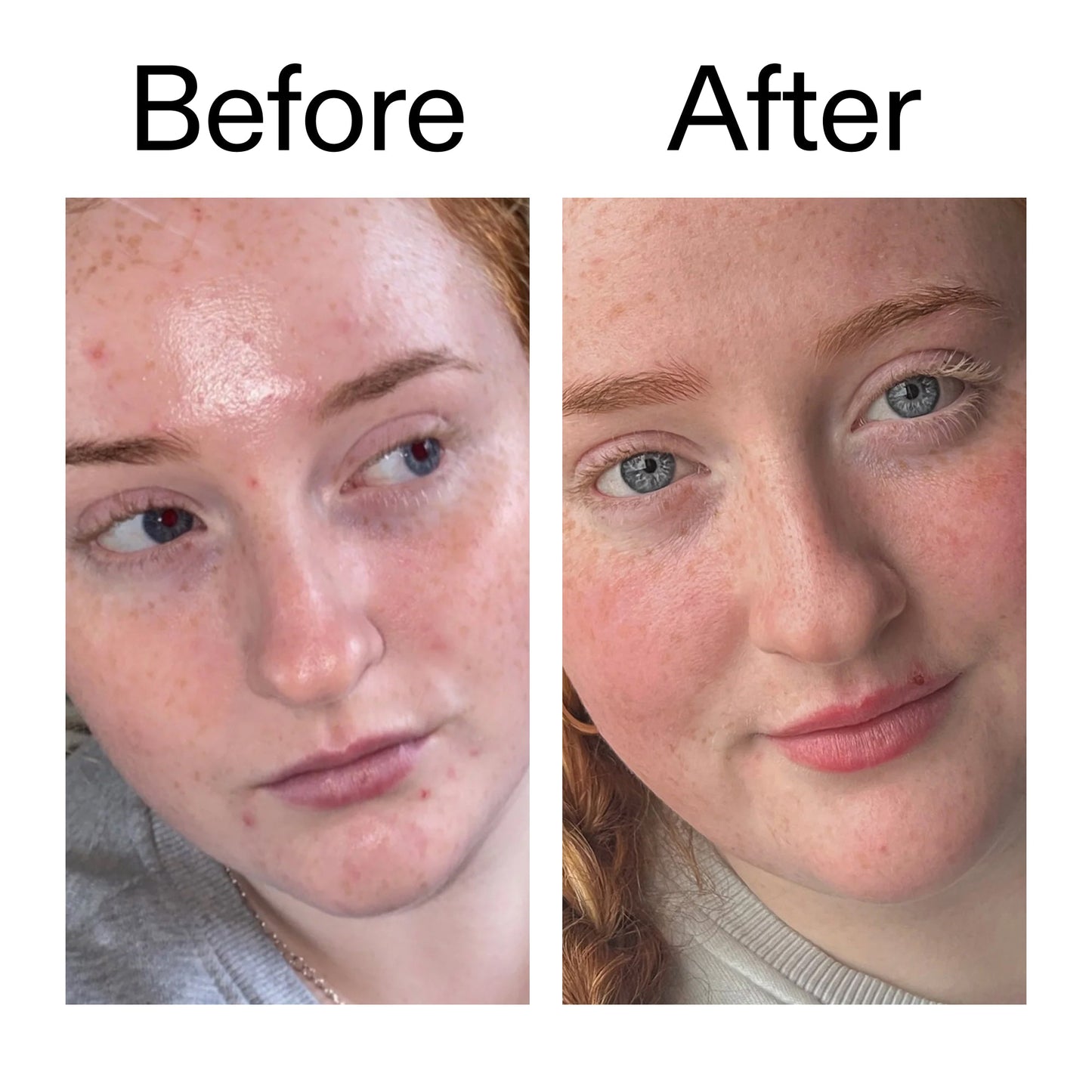 vitamin-b-c-and-e-moisturizer-t2 Vitamin_B_C_and_E_Moisturizer_Before_After_2000x2000_b0781a76-5ad2-4be9-95b8-ef92b356833c.jpg